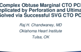 TCT 869: Complex Obtuse Marginal CTO PCI Complicated by Perforation and Ultimately Solved via Successful SVG CTO PCI