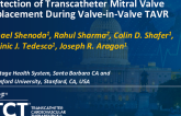 TCT 1149: Protection of Transcatheter Mitral Valve Replacement During Valve-in-Valve TAVR