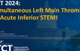 TCT 1270: Simultaneous Left Main Thrombus in Acute Inferior STEMI