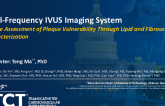 First-in-Human and Early Feasibility Studies with a Dual-Frequency IVUS Imaging System for the Assessment of Plaque Vulnerability Through Lipid and Fibrous Cap Characterization