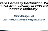 TCT 810:   Severe Coronary Perforation post orbital atherectomy in Guillain-Barre Syndrome with complex anatomy  