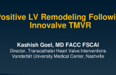 Positive LV Remodeling Following Innovalve TMVR