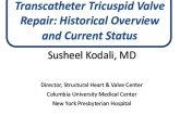 SPOTLIGHT LECTURE: Transcatheter Tricuspid Valve Repair: Historical Overview and Current Landscape
