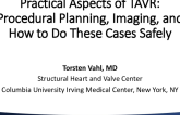 Practical Aspects of TAVR: Procedural Planning, Imaging, and How to Do These Cases Safely