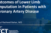 TCT 695: Trends and Outcomes of Lower Limb Amputation in Patients With Coronary Artery Disease: Insight From Nationwide Inpatient Sample