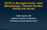 TAVR Bicuspid (Morphology, Calcium Location/Burden, Sizing, Aorta)