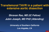 Transfemoral TAVR in a patient with extensive aortic dissection