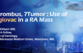 THROMBUS, Tumor : Use of Angiovac in a RA Mass