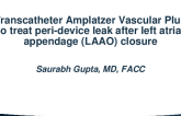 Transcatheter Amplatzer Vascular Plug to Treat Peri-Device Leak After Left Atrial Appendage (LAAO) Closure