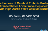 TCT 213: Effectiveness of Cerebral Embolic Protection in Transcatheter Aortic Valve Replacement with High Aortic Valve Calcium Burden