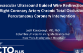 Intravascular Ultrasound Guided Puncture in a Right Coronary Artery Chronic Total Occlusion Percutaneous Coronary Intervention