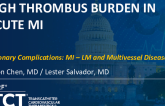 TCT 1436: High Thrombus Burden in Acute MI