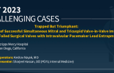 TCT 970: Trapped But Triumphant: A Case of Successful Simultaneous Mitral and Tricuspid Valve-in-Valve Implants for Failed Surgical Valves with Intravalvular Pacemaker Lead Entrapment