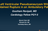 TCT 1512: Left Ventricular Pseudoaneurysm With Controlled Rupture in an Ambulatory Patient