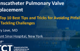 Pulmonary Intervention for Structural Interventionalist: My Best Tips and Tricks for Avoiding Pitfalls and Tackling Challenges