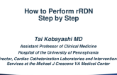 How to Perform rRDN (Medtronic) – Step by Step