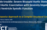 TCT 1237: Triple Trouble: Severe Bicuspid Aortic Stenosis and Aortic Coarctation With Severely Impaired Left Ventricle Systolic Function: A Stepwise Approach to a Complex Structural Case