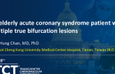 TCT 1273: An Elderly Acute Coronary Syndrome Patient With Multiple True Bifurcation Lesions