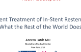 Current Treatment of In-Stent Restenosis: What the Rest of the World Does