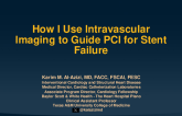 How I Use Intravascular Imaging to Guide PCI for Stent Failure