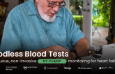 GPx -- Bloodless Blood Tests