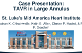 Navitor Case Presentation