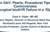 Surgical Valve-in-Valve TAVR: Clinical Pearls, Procedural Tips, and Controversies