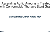 Ascending Aortic Aneurysm Treated With Conformable Thoracic Stent Graft