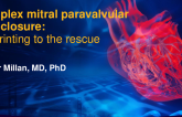 TCT 962: Complex mitral paravalvular leak closure: 3D printing to the rescue