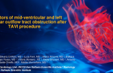 TCT 693: Predictors of Mid-ventricular and Left Ventricular Outflow Tract Obstruction After Transcatheter Aortic Valve Replacement: a High Volume Single Center Experience