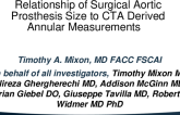 TCT 22: Relationship of Surgical Aortic Prosthesis Size to CTA Derived Annular Measurements   