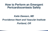 How to Perform Emergent Pericardiocentesis Safer