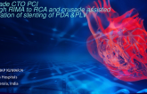 TCT 831: Retrograde CTO PCI         through RIMA to RCA and crusade assisted bifurcation of stenting of PDA &PLV