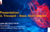 Case Presentation: Pascal – Basic and Complex
