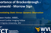 TCT 1389: Importance of Brockenbrough-Braunwald-Morrow Sign in Differentiating Static Versus Dynamic Obstruction: An Interesting Case
