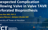 TCT 1586: Unexpected Complication Following Valve in Valve TAVR for Perforated Bioprosthesis