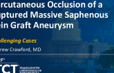 TCT 1299: Percutaneous Occlusion of a Ruptured Massive Saphenous Vein Graft Aneurysm