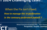 TCT 1336: When the Fix Isn't Fixed: How to Management in Re Perforate Coronary Perforation Patient?