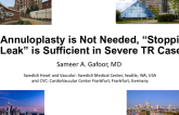 Con: Annuloplasty is Not Needed, “Stopping the Leak” is Sufficient in Severe TR Cases!