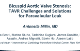 Bicuspid Aortic Valve Stenosis: TAVR Challenges and Solutions for Paravalvular Leak