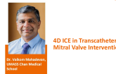 4D ICE Imaging of the Mitral Valve