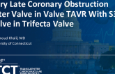 TCT 1286: Very Late Coronary Obstruction After Valve in Valve TAVR With S3U Valve in Trifecta Valve