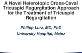 A Novel Heterotopic Tricuspid Regurgitation Device for the Treatment of Tricuspid Regurgitation (Innoventric)