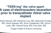 “TEER-Ing” the Valve Apart: A Case of Electrocautery Laceration Prior to Transcutaneous Mitral Valve Implant