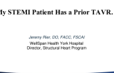 My STEMI Patient Has a Prior TAVR…