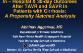 TCT 67: Comparison of In-hospital Outcomes and Thirty-Day Readmission Rates Between Patients who Underwent TAVR Versus SAVR for Aortic Stenosis in Liver Cirrhosis: A Propensity Matched Analysis