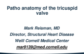 Patho-Anatomy of the Tricuspid Valve