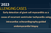 TCT 923: Early Detection Of Giant Cell Myocarditis as a Cause of Recurrent Ventricular Tachycardia Using Intracardiac Echocardiography-guided Endomyocardial Biopsy