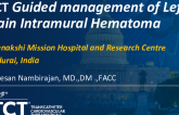 TCT 1481: OCT Guided Management of Iatrogenic Left Main Intramural Hematoma
