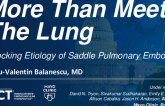 TCT 1473: More Than Meets the Lung: Shocking Etiology of Saddle Pulmonary Embolism